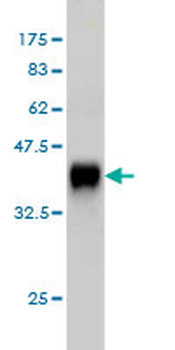 CACNB2 monoclonal antibody (M05), clone 6C4