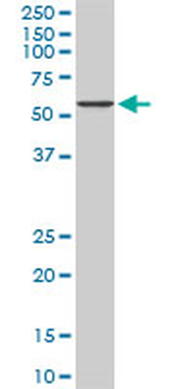 CACNB2 monoclonal antibody (M01), clone 6C1
