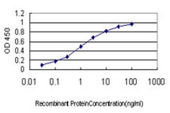 CACNB2 monoclonal antibody (M01), clone 6C1