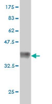 CACNB2 monoclonal antibody (M01), clone 6C1