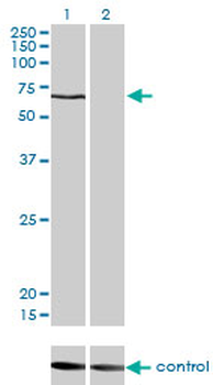 CACNB1 monoclonal antibody (M01), clone 1G6