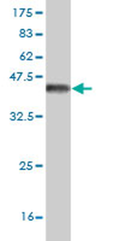 CACNB1 monoclonal antibody (M01), clone 1G6