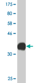 CACNA1C monoclonal antibody (M20), clone 4D10