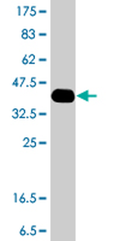 CACNA1C polyclonal antibody (A01)