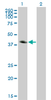 CA12 monoclonal antibody (M01), clone 1D4