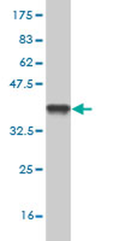 CA12 monoclonal antibody (M01), clone 1D4