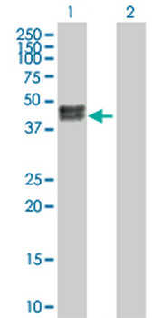 CA12 purified MaxPab rabbit polyclonal antibody (D01P)