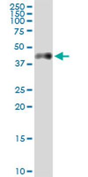 CA12 MaxPab rabbit polyclonal antibody (D01)