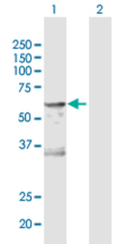 CA9 MaxPab rabbit polyclonal antibody (D01)