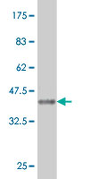 CA7 monoclonal antibody (M06), clone 3B7