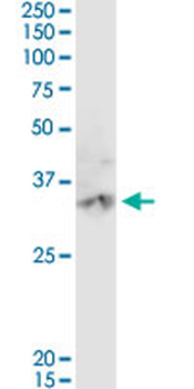 CA3 purified MaxPab rabbit polyclonal antibody (D01P)