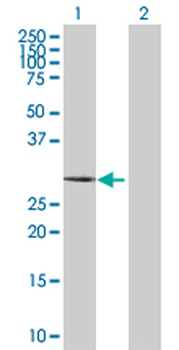 CA3 purified MaxPab rabbit polyclonal antibody (D01P)