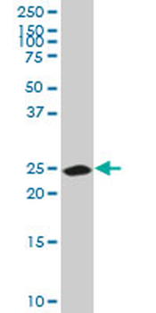 CA1 monoclonal antibody (M05), clone M1