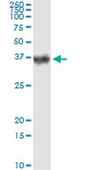 CA1 monoclonal antibody (M05), clone M1