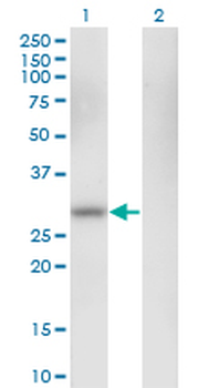 CA1 monoclonal antibody (M05), clone M1