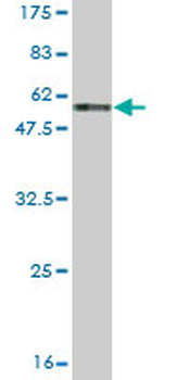 CA1 monoclonal antibody (M05), clone M1