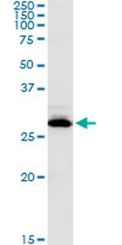 CA1 purified MaxPab rabbit polyclonal antibody (D01P)