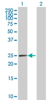 CA1 purified MaxPab rabbit polyclonal antibody (D01P)