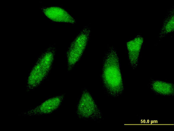 PTTG1IP monoclonal antibody (M04), clone 4C11