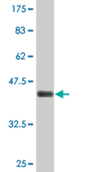 PTTG1IP monoclonal antibody (M04), clone 4C11