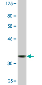 FMNL1 monoclonal antibody (M01), clone 1D7