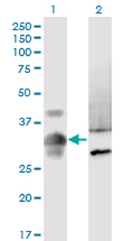 MPPED2 monoclonal antibody (M08), clone 4H5