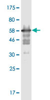 MPPED2 monoclonal antibody (M08), clone 4H5