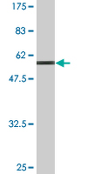 MPPED2 monoclonal antibody (M01A), clone 2G1-1B7