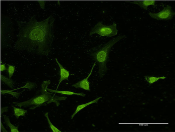 C4B monoclonal antibody (M03), clone 1F2