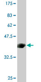 C4B monoclonal antibody (M03), clone 1F2