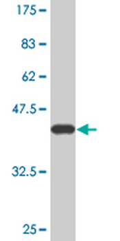 C3 monoclonal antibody (M01A), clone 5F9