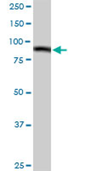 C1S purified MaxPab rabbit polyclonal antibody (D01P)