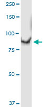 C1S MaxPab rabbit polyclonal antibody (D01)