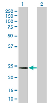 C1QC purified MaxPab rabbit polyclonal antibody (D01P)