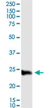 C1QC MaxPab rabbit polyclonal antibody (D01)