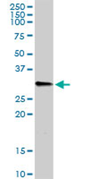 C1QB purified MaxPab rabbit polyclonal antibody (D01P)