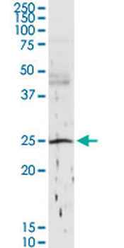 C1QB purified MaxPab rabbit polyclonal antibody (D01P)