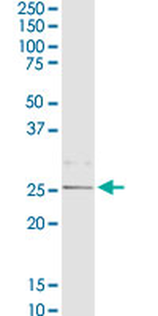 C1QB purified MaxPab rabbit polyclonal antibody (D01P)