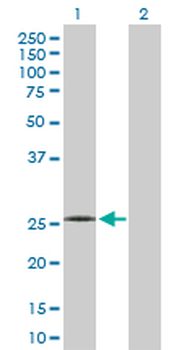 C1QB purified MaxPab rabbit polyclonal antibody (D01P)