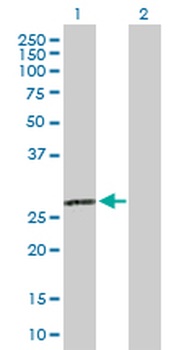 C1QA purified MaxPab rabbit polyclonal antibody (D01P)