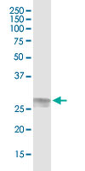 C1QA MaxPab rabbit polyclonal antibody (D01)