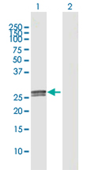 C1QA MaxPab rabbit polyclonal antibody (D01)