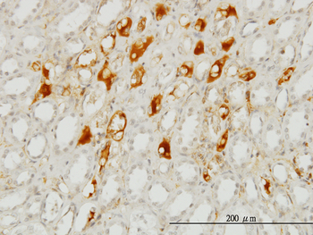 SERPING1 monoclonal antibody (M01), clone 3F4-1D9
