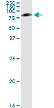 SERPING1 monoclonal antibody (M01), clone 3F4-1D9
