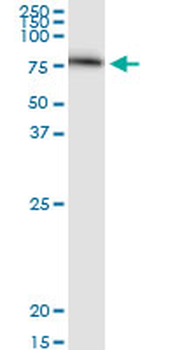 SERPING1 monoclonal antibody (M01), clone 3F4-1D9