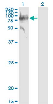 SERPING1 monoclonal antibody (M01), clone 3F4-1D9