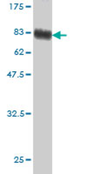 SERPING1 monoclonal antibody (M01), clone 3F4-1D9