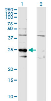 C1QBP MaxPab rabbit polyclonal antibody (D01)