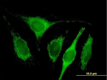 C1QBP purified MaxPab mouse polyclonal antibody (B01P)