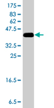 C1QBP polyclonal antibody (A01)